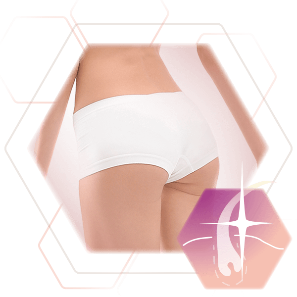 Permanent hair removal women | Overview body areas