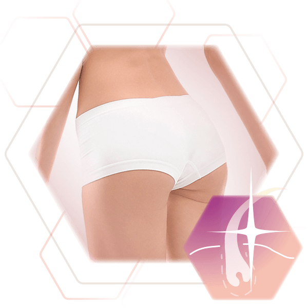 Body region permanent hair removal buttocks gluteal fold butt woman stuttgart