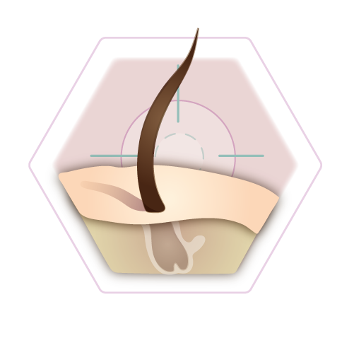 Button illustration hair removal overview